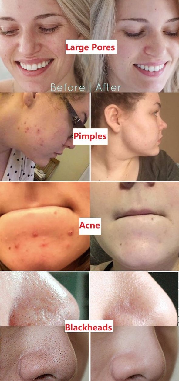 Diystar™  100% Natural Green Tea Deep Cleanse Mask