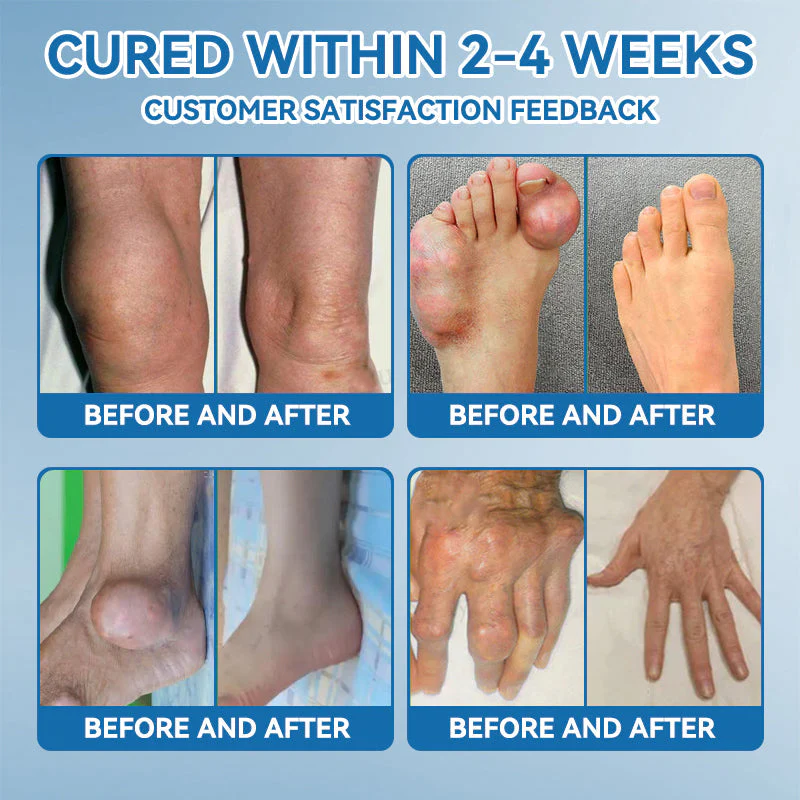 𝐅𝐃𝐀 𝐀𝐩𝐩𝐫𝐨𝐯𝐞𝐝👩‍⚕️|LOVILDS® 𝑩𝐏𝐂-𝟏𝟓𝟕 𝐉𝐨𝐢𝐧𝐭 𝐇𝐞𝐚𝐥𝐢𝐧𝐠 𝐂𝐫𝐞𝐚𝐦🦴 Relief for Arthritis, Neuropathy, Rheumatism & Sports Injuries & 𝐌𝐨𝐫𝐞