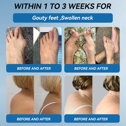 𝐅𝐃𝐀 𝐀𝐩𝐩𝐫𝐨𝐯𝐞𝐝👩‍⚕️|LOVILDS® 𝑩𝐏𝐂-𝟏𝟓𝟕 𝐉𝐨𝐢𝐧𝐭 𝐇𝐞𝐚𝐥𝐢𝐧𝐠 𝐂𝐫𝐞𝐚𝐦🦴 Relief for Arthritis, Neuropathy, Rheumatism & Sports Injuries & 𝐌𝐨𝐫𝐞