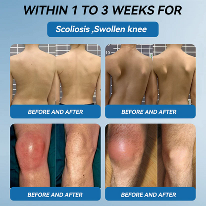 𝐅𝐃𝐀 𝐀𝐩𝐩𝐫𝐨𝐯𝐞𝐝👩‍⚕️|LOVILDS® 𝑩𝐏𝐂-𝟏𝟓𝟕 𝐉𝐨𝐢𝐧𝐭 𝐇𝐞𝐚𝐥𝐢𝐧𝐠 𝐂𝐫𝐞𝐚𝐦🦴 Relief for Arthritis, Neuropathy, Rheumatism & Sports Injuries & 𝐌𝐨𝐫𝐞