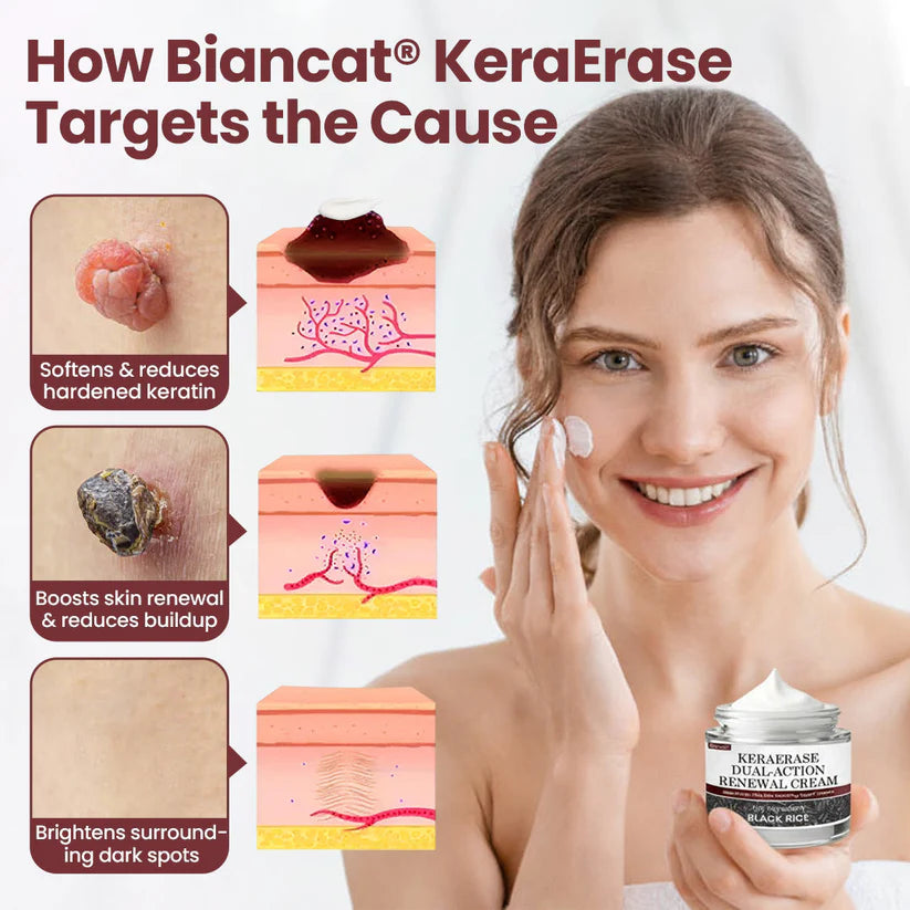 BBOJI®KeraErase Dual-Action Renewal Cream