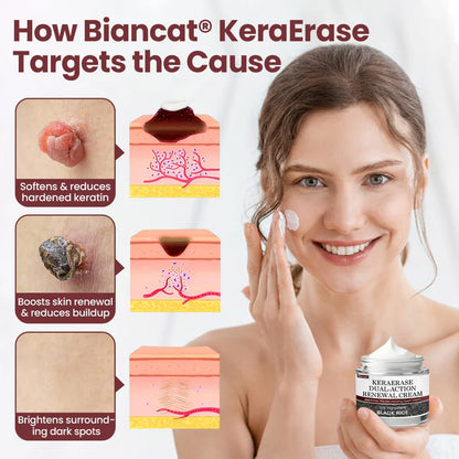 BBOJI®KeraErase Dual-Action Renewal Cream