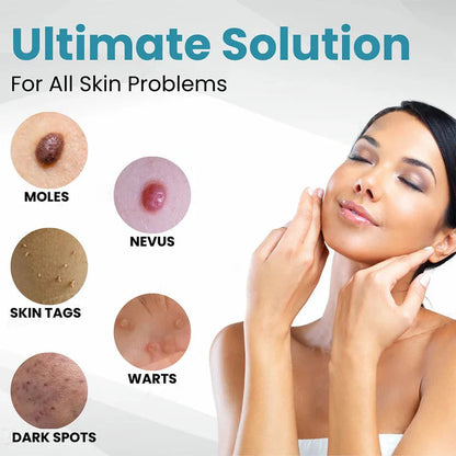 🔥【OFFICIAL STORE】LOVILDS™ Non-Invasive Mole and Wart Removal Laser Pen