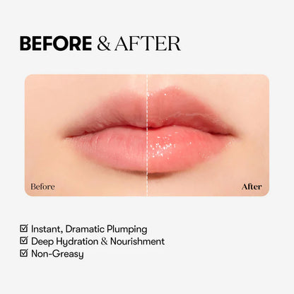 💗LAST DAY - BUY 1 GET 1 FREE💗 Reedle Shot Lip Plumperr - K-Beauty Tech ✨