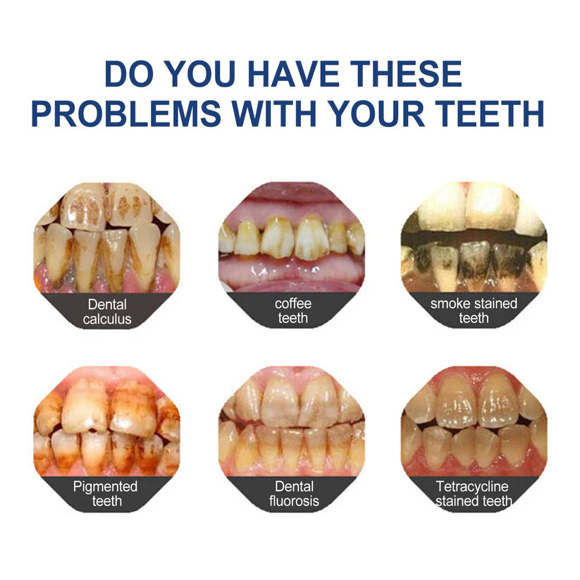 🔥Limited Time Deal!70% OFF🎁 BBOJI™ Fluoride-Free Hydroxyapatite Toothpaste – Gentle Whitening & Enamel Strength for Sensitive Teeth