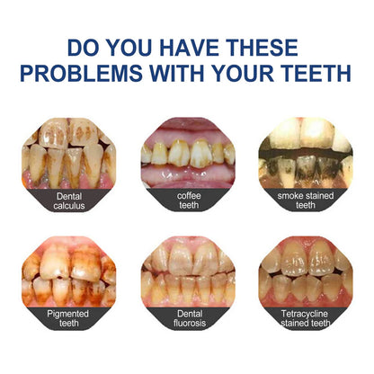 🔥Limited Time Deal!70% OFF🎁 BBOJI™ Fluoride-Free Hydroxyapatite Toothpaste – Gentle Whitening & Enamel Strength for Sensitive Teeth