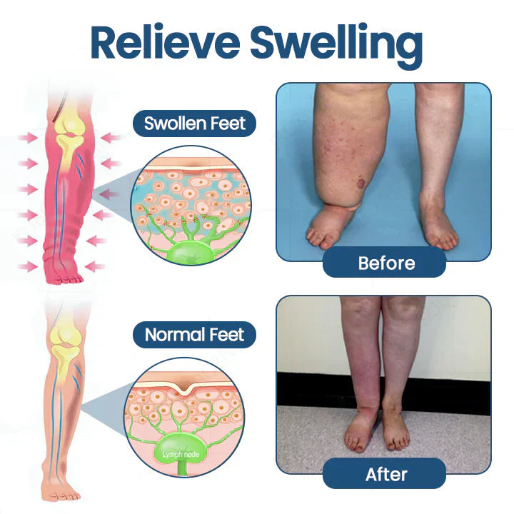 Cougex® Roll-On Pump Cream for Lymphatic Drainage & Swelling Relief