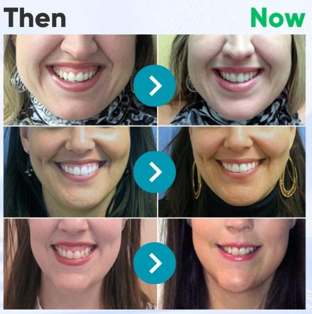 Rolimey® VioCore Zahnpasta mit Bienengift zur Zahnbehandlung