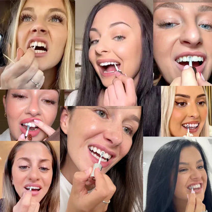 Smileasego™ Tooth Polisher — Instantly Whiter Smile🦷