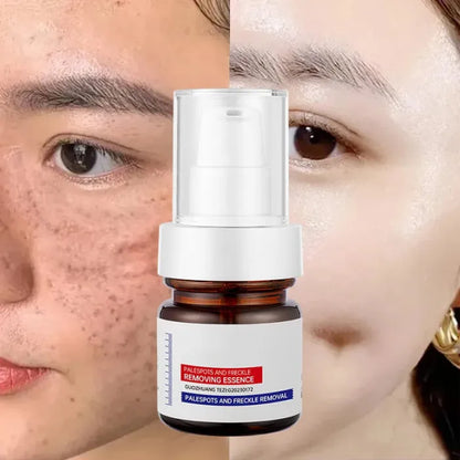⚡5-second brightening rescue: Dark spots disappear, blemishes fade, and skin becomes radiant! Vitamin C Whitening Freckles ESSENCE