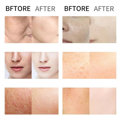 ⚡5-second brightening rescue: Dark spots disappear, blemishes fade, and skin becomes radiant! Vitamin C Whitening Freckles ESSENCE