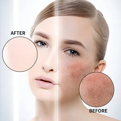 ⚡5-second brightening rescue: Dark spots disappear, blemishes fade, and skin becomes radiant! Vitamin C Whitening Freckles ESSENCE