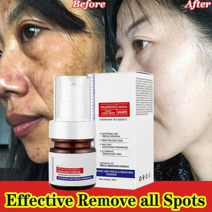 ⚡5-second brightening rescue: Dark spots disappear, blemishes fade, and skin becomes radiant! Vitamin C Whitening Freckles ESSENCE