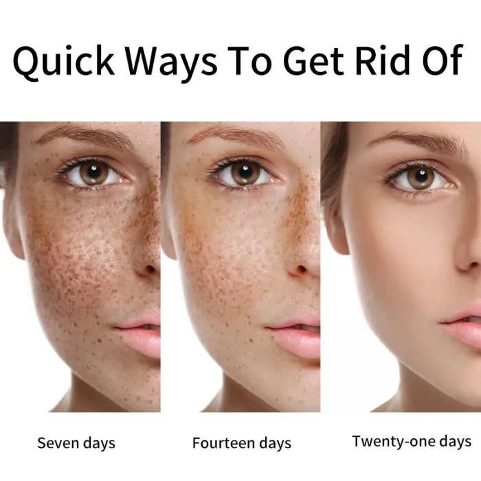 ⚡5-second brightening rescue: Dark spots disappear, blemishes fade, and skin becomes radiant! Vitamin C Whitening Freckles ESSENCE